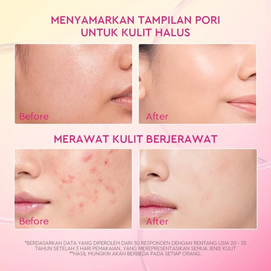 GLAD2GLOW Pomegranate Niacinamide Brightening Anti-Acne Care Moisturizer