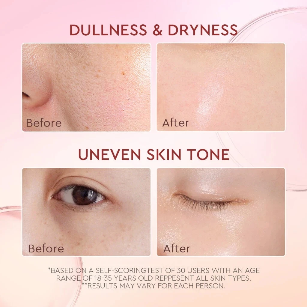 GLAD2GLOW Pomegranate Niacinamide Brightening Anti-Acne Care Moisturizer